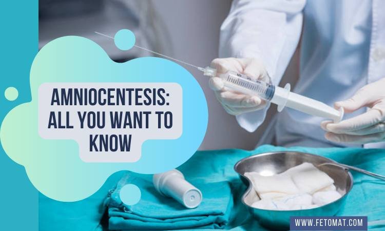 Amniocentesis: All You Want to Know