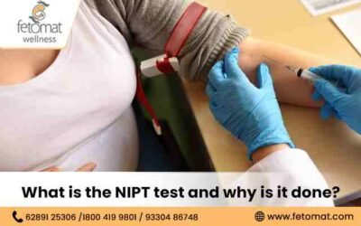 What is the NIPT test and why is it done?