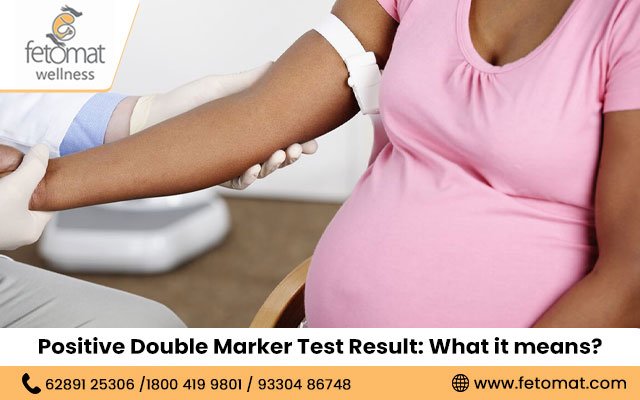 Positive Double Marker Test Result: What it means?