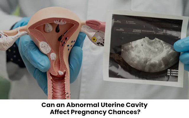 Can an Abnormal Uterine Cavity Affect Pregnancy Chances?