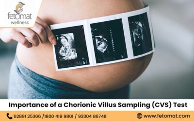  Importance of Chorionic Villus Sampling (CVS) Test