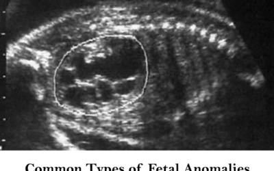 Common Types of Fetal Anomalies