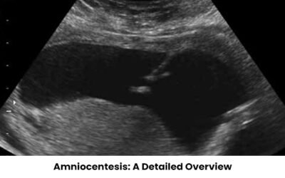 Amniocentesis: A Detailed Overview